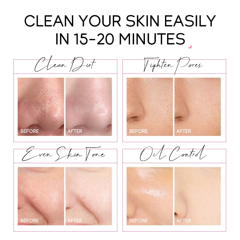 24K Gold Peeling Face Mask Anti Wrinkle Whitening Acne Blackhead Removal